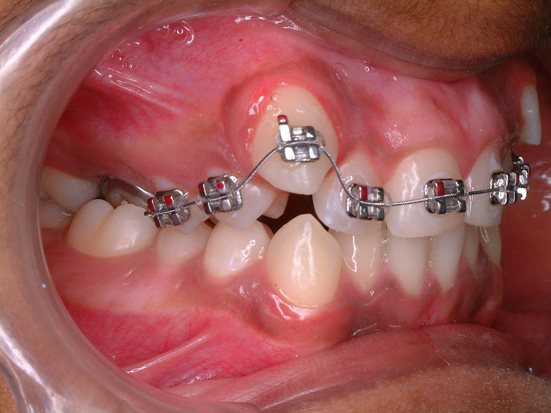product 3